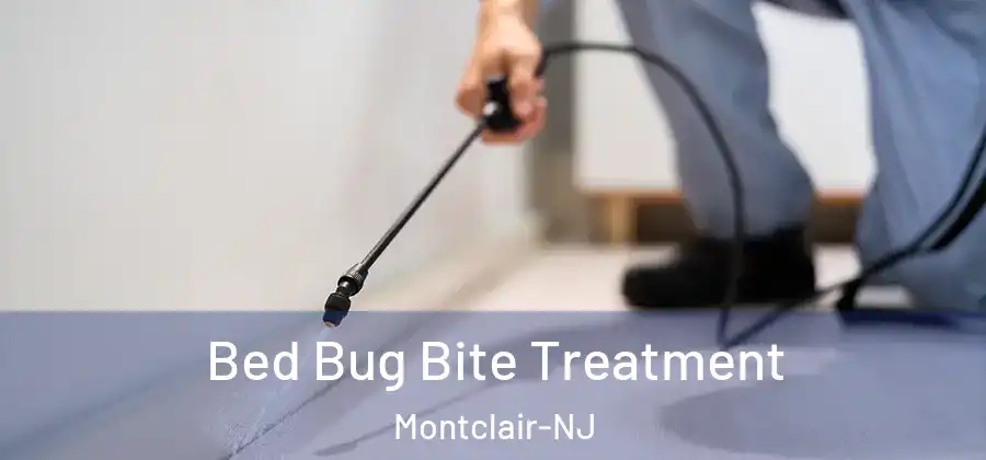 Bed Bug Bite Treatment Montclair-NJ